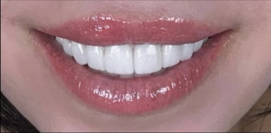 After dental treatment