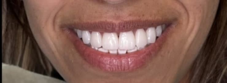 After dental treatment