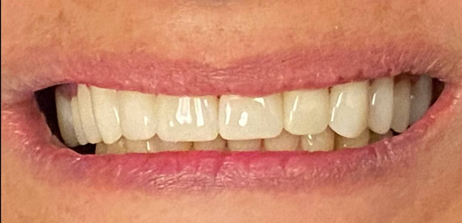 After dental treatment