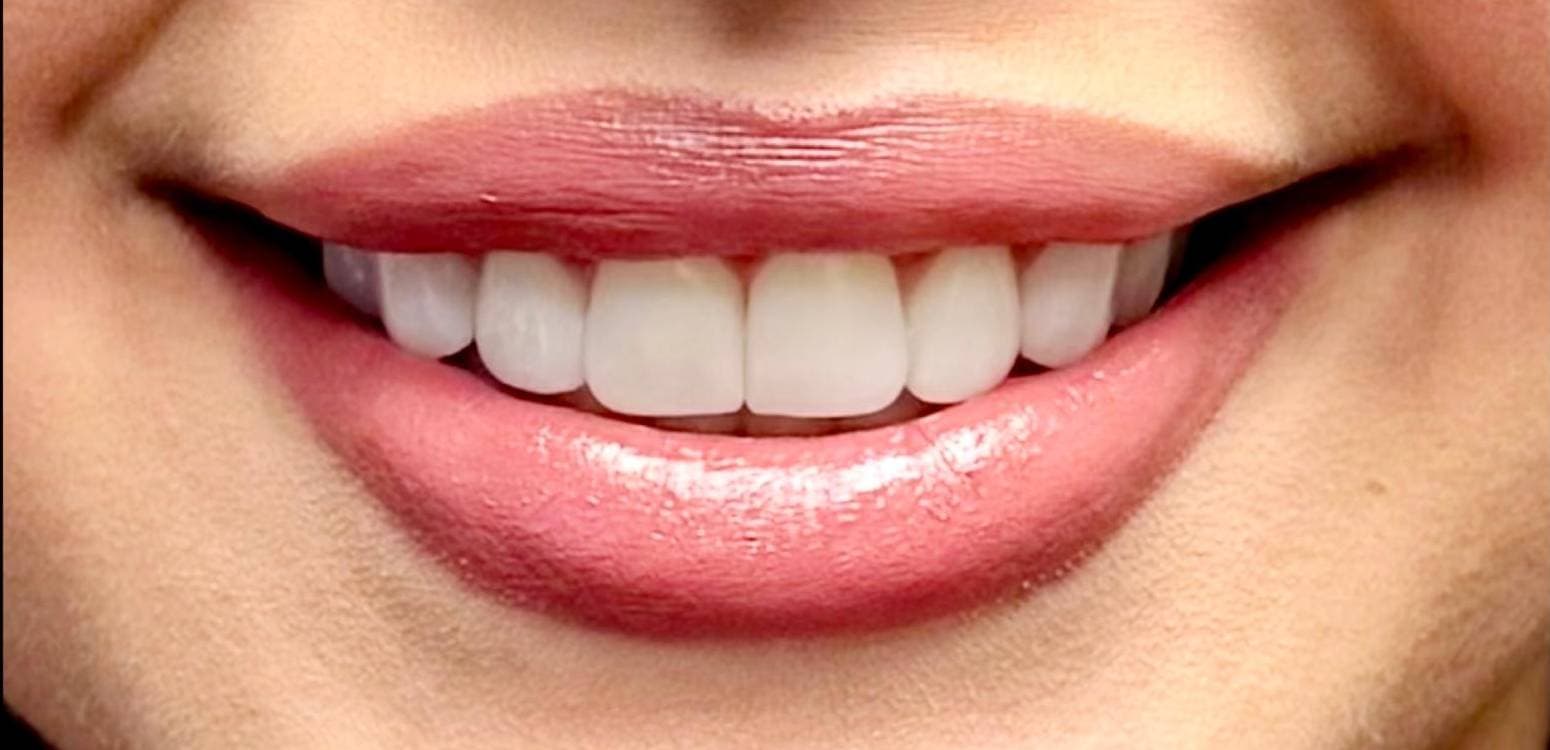 After dental treatment