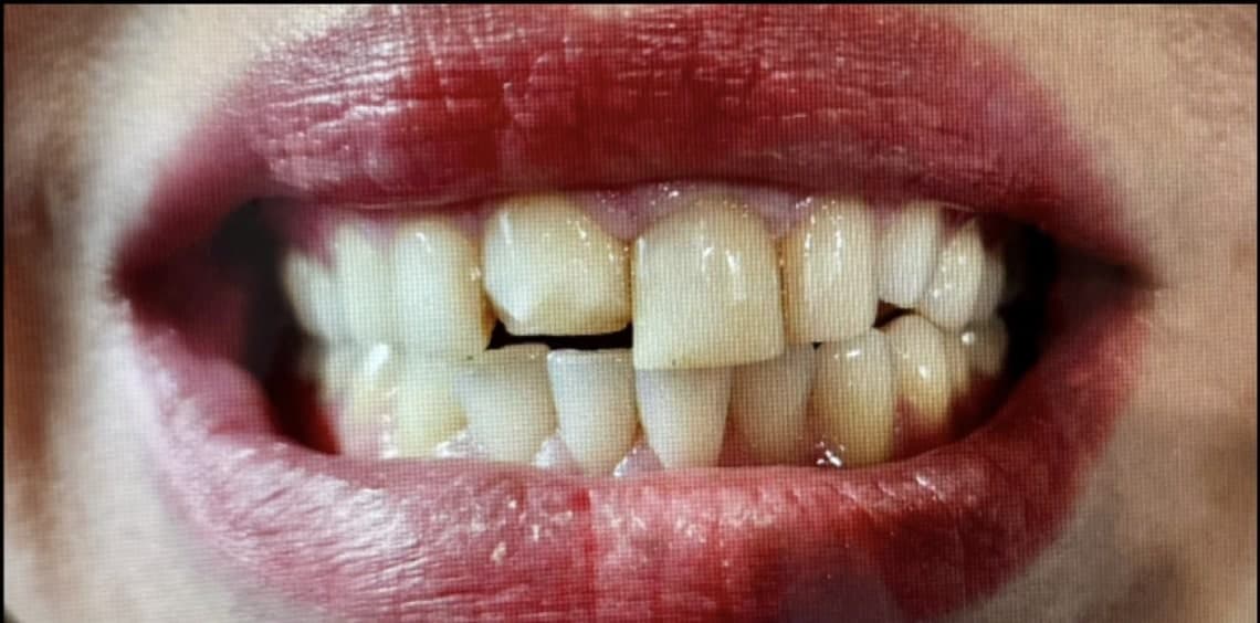 Before dental treatment