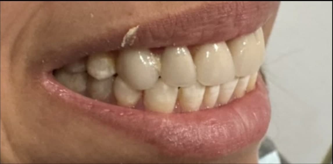 Before dental treatment