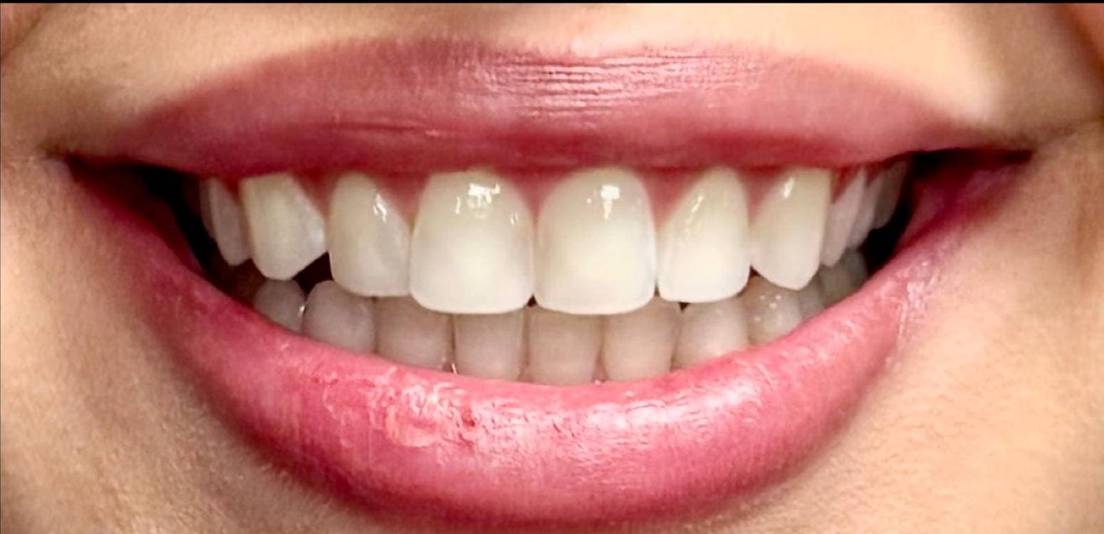 Before dental treatment